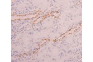 Used in DAB staining on fromalin fixed paraffin- embedded kidney tissue (PDE3A anticorps  (AA 948-1141))