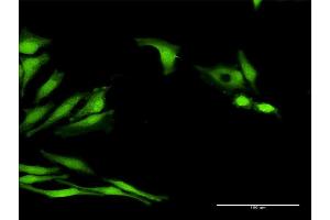 Immunofluorescence of purified MaxPab antibody to LOC541473 on HeLa cell. (LOC541473 anticorps  (AA 1-131))
