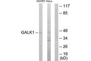 Western blot analysis of extracts from HuvEc/HeLa cells, using GALK1 Antibody. (GALK1 anticorps  (AA 1-50))