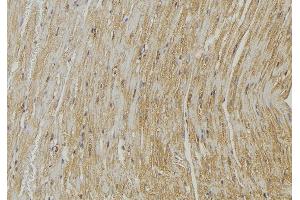 ABIN6272862 at 1/100 staining Mouse muscle tissue by IHC-P. (PLOD2 anticorps  (C-Term))