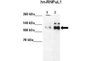 Lanes :  Lane 1: 5ug HeLa S3 Lane 2: 10ug HeLa S3   Primary Antibody Dilution :   1:4000    Secondary Antibody :  Anti-rabbit-HRP   Secondary Antibody Dilution :   1:5000   Gene Name :  HNRPUL1   Submitted by :  Anonymous