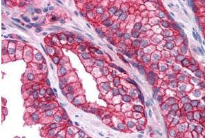 Human Prostate: Formalin-Fixed, Paraffin-Embedded (FFPE)