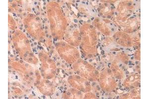 Detection of ANGPTL2 in Mouse Kidney Tissue using Polyclonal Antibody to Angiopoietin Like Protein 2 (ANGPTL2)