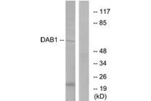 Western blot analysis of extracts from HeLa cells, using Dab1 (Ab-220) Antibody. (DAB1 anticorps  (AA 187-236))