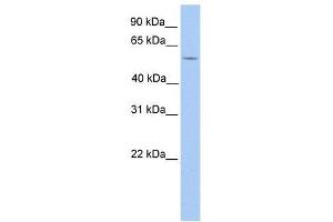 anti-LIM Domains Containing 1 (LIMD1) (N-Term) antibody