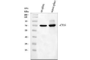 Western blot analysis of CD5 using anti-CD5 antibody (ABIN5693203). (CD5 anticorps  (AA 25-495))