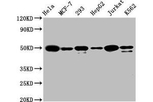 Western Blot Positive WB detected in: Hela whole cell lysate, MCF-7 whole cell lysate, 293 whole cell lysate, HepG2 whole cell lysate, Jurkat whole cell lysate, K562 whole cell lysate All lanes: ATF4 antibody at 1. (Recombinant ATF4 anticorps)