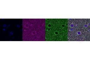 Immunohistochemistry (IHC) image for anti-ATP Synthase, H+ Transporting, Mitochondrial F1 Complex, alpha Subunit 1, Cardiac Muscle (ATP5A1) antibody (ABIN7456225)