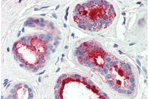 Human Breast (formalin-fixed, paraffin-embedded) stained with PIP antibody ABIN337224 at 2. (PIP anticorps  (AA 24-34))