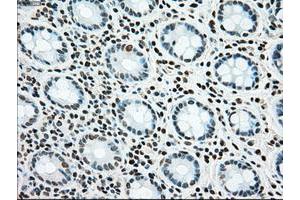 Image no. 15 for anti-Sjogren Syndrome Antigen B (SSB) antibody (ABIN1501146)