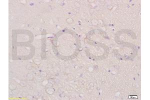 Formalin-fixed and paraffin embedded rat brain labeled with Anti-CHRNA4 Polyclonal Antibody, Unconjugated (ABIN736746) at 1:200 followed by conjugation to the secondary antibody and DAB staining. (CHRNA4 anticorps  (AA 531-627))
