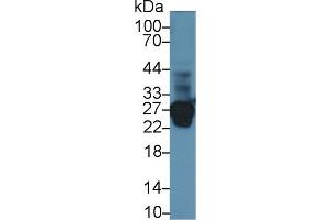 Detection of TNNI1 in Rat Skeletal muscle lysate using Polyclonal Antibody to Troponin I Type 1, Slow Skeletal (TNNI1)