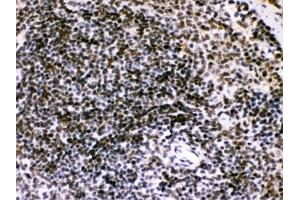 IHC testing of FFPE mouse spleen with BIK antibody. (BIK anticorps  (AA 1-123))