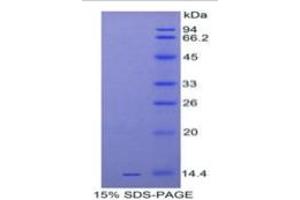 SDS-PAGE of Protein Standard from the Kit  (Highly purified E.