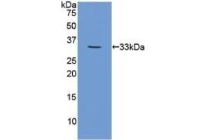 Detection of Recombinant CAPN1, Human using Polyclonal Antibody to Calpain 1 (CAPN1) (CAPN1 anticorps  (AA 75-343))
