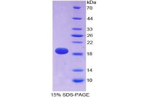 SDS-PAGE analysis of Rat alpha Fodrin Protein. (SPTAN1 Protéine)