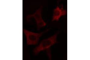 ABIN6274663 staining LOVO cells by IF/ICC. (CYP7B1 anticorps  (Internal Region))