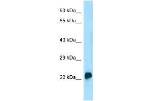 WB Suggested Anti-CRYGA Antibody Titration: 1. (CRYGA anticorps  (N-Term))