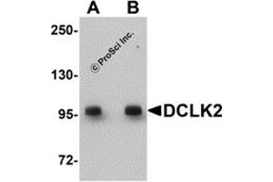 Western Blotting (WB) image for anti-Doublecortin-Like Kinase 2 (DCLK2) (C-Term) antibody (ABIN1030358)