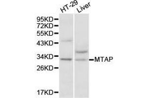 Western Blotting (WB) image for anti-Methylthioadenosine phosphorylase (MTAP) antibody (ABIN1875403) (MTAP anticorps)