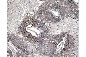 IHC analysis of Claudin 3/CLDN3 using anti-Claudin 3/CLDN3 antibody (ABIN7599626). (Claudin 3 anticorps  (AA 101-220))