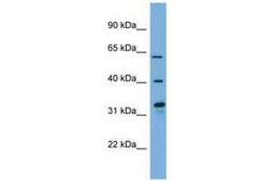 Image no. 1 for anti-Flavin Containing Monooxygenase 3 (FMO3) (N-Term) antibody (ABIN6744773) (FMO3 anticorps  (N-Term))