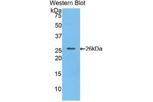 Western blot analysis of the recombinant protein. (Cardiotrophin 1 anticorps  (AA 1-203))