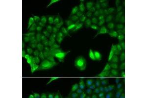 Immunofluorescence analysis of HeLa cells using SSX2 Polyclonal Antibody (SSX2 anticorps)