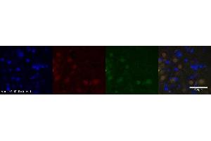 Immunohistochemistry (IHC) image for anti-Nuclear Receptor Subfamily 3, Group C, Member 2 (NR3C2) antibody (ABIN7456215)