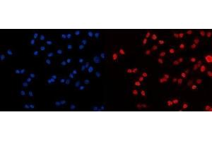 IF analysis of HDAC2 using anti-HDAC2 antibody (ABIN7601564). (HDAC2 anticorps  (AA 387-488))