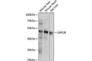 Western blot analysis of extracts of various cell lines, using LMX1B antibody (ABIN6133792, ABIN6143278, ABIN6143281 and ABIN6218228) at 1:1000 dilution. (LMX1B anticorps  (AA 1-100))