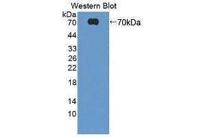 Western blot analysis of the recombinant protein. (HABP2 anticorps  (AA 24-560))