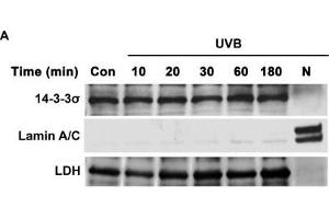 AKT cooperates with 14-3-3σ to facilitate nuclear translocation of TC45 in response to UVB irradiationWestern blot analysis of A.