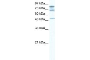 Western Blotting (WB) image for anti-DEAD (Asp-Glu-Ala-Asp) Box Polypeptide 46 (DDX46) antibody (ABIN2461582) (DDX46 anticorps)