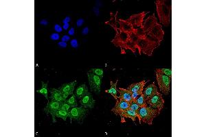 Immunocytochemistry/Immunofluorescence analysis using Mouse Anti-Ataxin 1 Monoclonal Antibody, Clone S76-8 . (Ataxin 1 anticorps  (AA 164-197) (Atto 594))