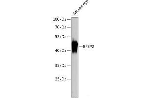 Western blot analysis of extracts of Mouse eye using BFSP2 Polyclonal Antibody at dilution of 1:3000. (BFSP2 anticorps)
