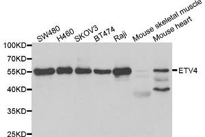 Western blot analysis of extracts of various cell lines, using ETV4 antibody. (ETV4 anticorps)
