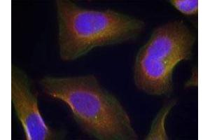 Immunofluorescent staining of methanol-fixed Hela cells using PRKCQ (phospho S676) polyclonal antibody  at 1:100-1:200 dilution. (PKC theta anticorps  (pSer676))
