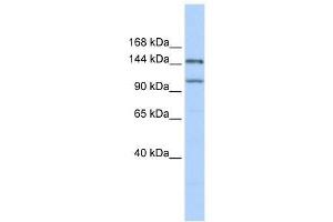 Western Blot showing PRDM9 antibody used at a concentration of 1. (PRDM9 anticorps  (Middle Region))