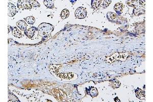 IHC analysis of CETP using anti-CETP antibody (ABIN7602439).