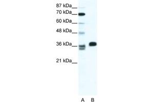 Western Blotting (WB) image for anti-ESX Homeobox 1 (ESX1) antibody (ABIN2461319)