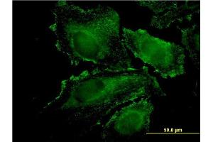 Immunofluorescence of monoclonal antibody to RHOJ on HeLa cell.