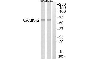Western blot analysis of extracts from HuvEc cells and HepG2 cells, using CAMKK2 antibody. (CAMKK2 anticorps  (Internal Region))