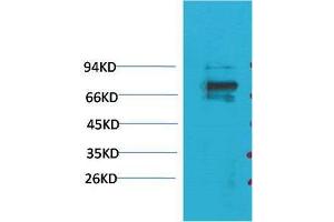 Western Blot (WB) analysis of 293T with KV1. (KCNA5 anticorps)