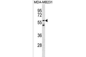 LGI3 Antibody (Center) (ABIN1881494 and ABIN2838431) western blot analysis in MDA-M cell line lysates (35 μg/lane). (LGI3 anticorps  (AA 310-338))