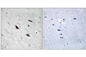 Immunohistochemistry analysis of paraffin-embedded human brain tissue using Catenin- beta (Phospho-Tyr489) antibody. (beta Catenin anticorps  (pTyr489))