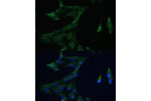 Immunofluorescence analysis of C6 cells using  Polyclonal Antibody (ABIN7265493) at dilution of 1:100 (40x lens).