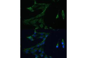 Immunofluorescence analysis of C6 cells using  Polyclonal Antibody (ABIN7265493) at dilution of 1:100 (40x lens).