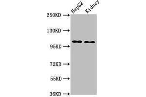 Western Blot Positive WB detected in: HepG2 whole cell lysate, Rat kidney tissue All lanes: PCSK5 antibody at 6 μg/mL Secondary Goat polyclonal to rabbit IgG at 1/50000 dilution Predicted band size: 207, 102 kDa Observed band size: 102 kDa (PCSK5 anticorps  (AA 201-500))