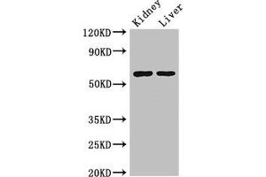 Western Blot Positive WB detected in: Mouse kidney tissue, Mouse liver tissue All lanes: ALDH6A1 antibody at 2. (ALDH6A1 anticorps  (AA 274-399))